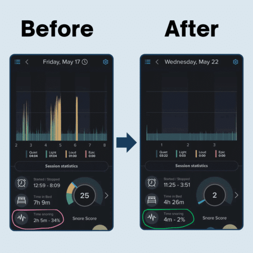 SnoreSnoozer Pro (Official Retailer) 2026