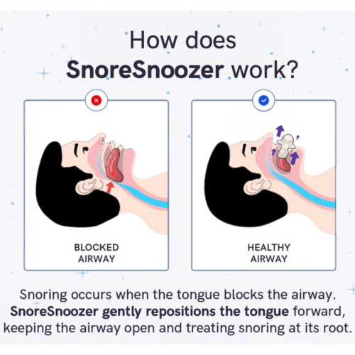 Snoresnoozer Pro (Official Retailer) [year]